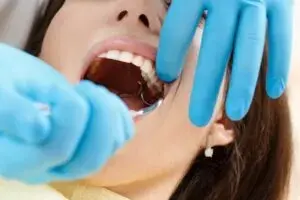 Что такое резекция корня зуба и когда ее нужно делать?